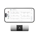 Kardiamobile 6-Kanal-EKG-Herzfrequenzmesser – Sechs Ansichten des Herzens – Erkennt...