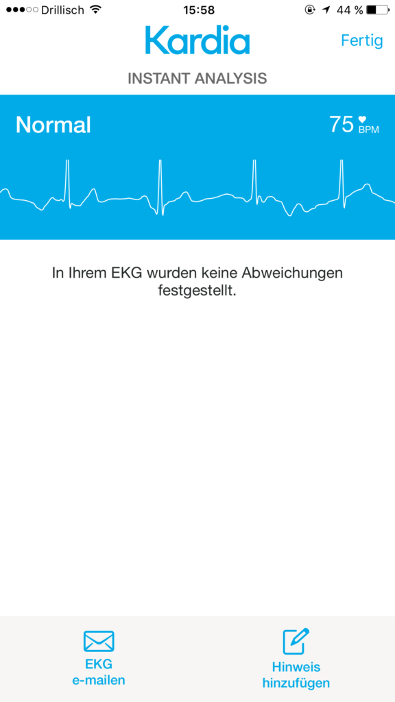 AliveCor Kardia Mobile - mobiles EKG Screenshot der App